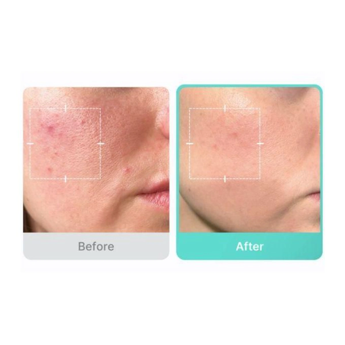 سيروم مهدئ أزيليك أسيد BB تركيز 16% - 10 مل