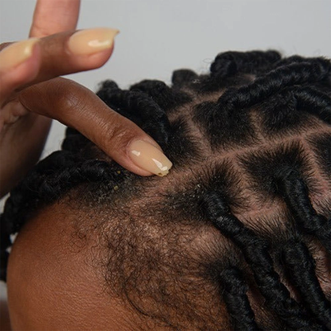 علاج الشعر وفروة الرأس كوزا هيمب الهندي - 226 جرام