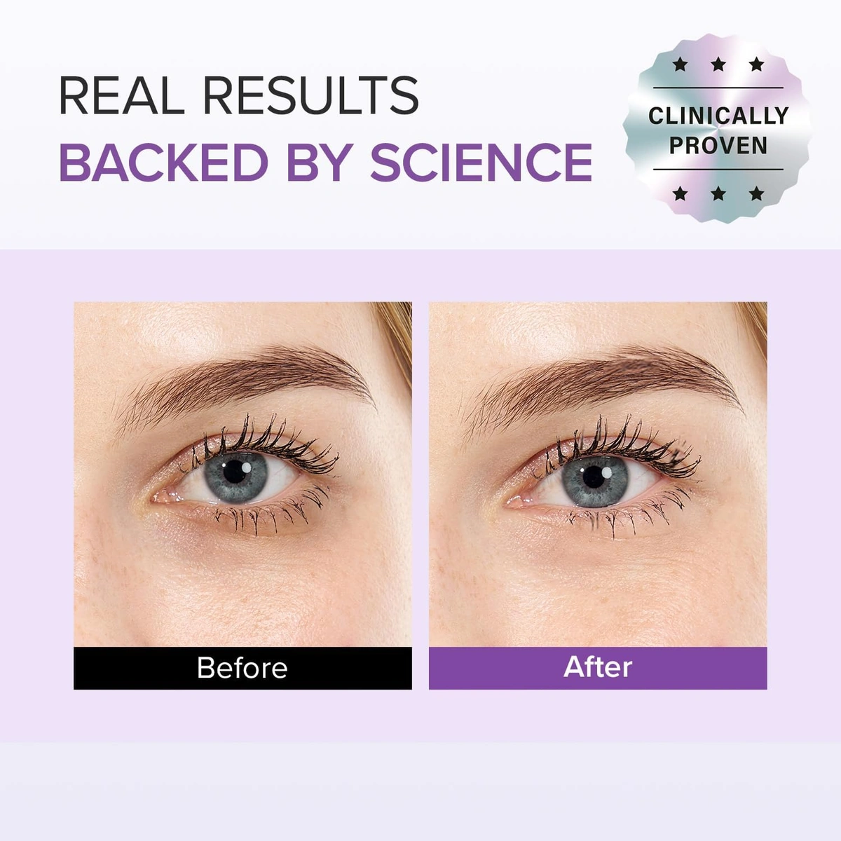 طقم كريم عين ترانكساميك أسيد + جلوتاثيون