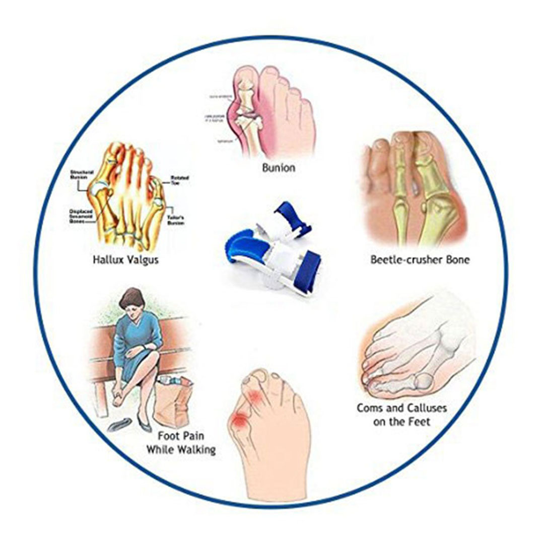 جهاز تقويم أصبع القدم الكبير - قابل للتعديل
