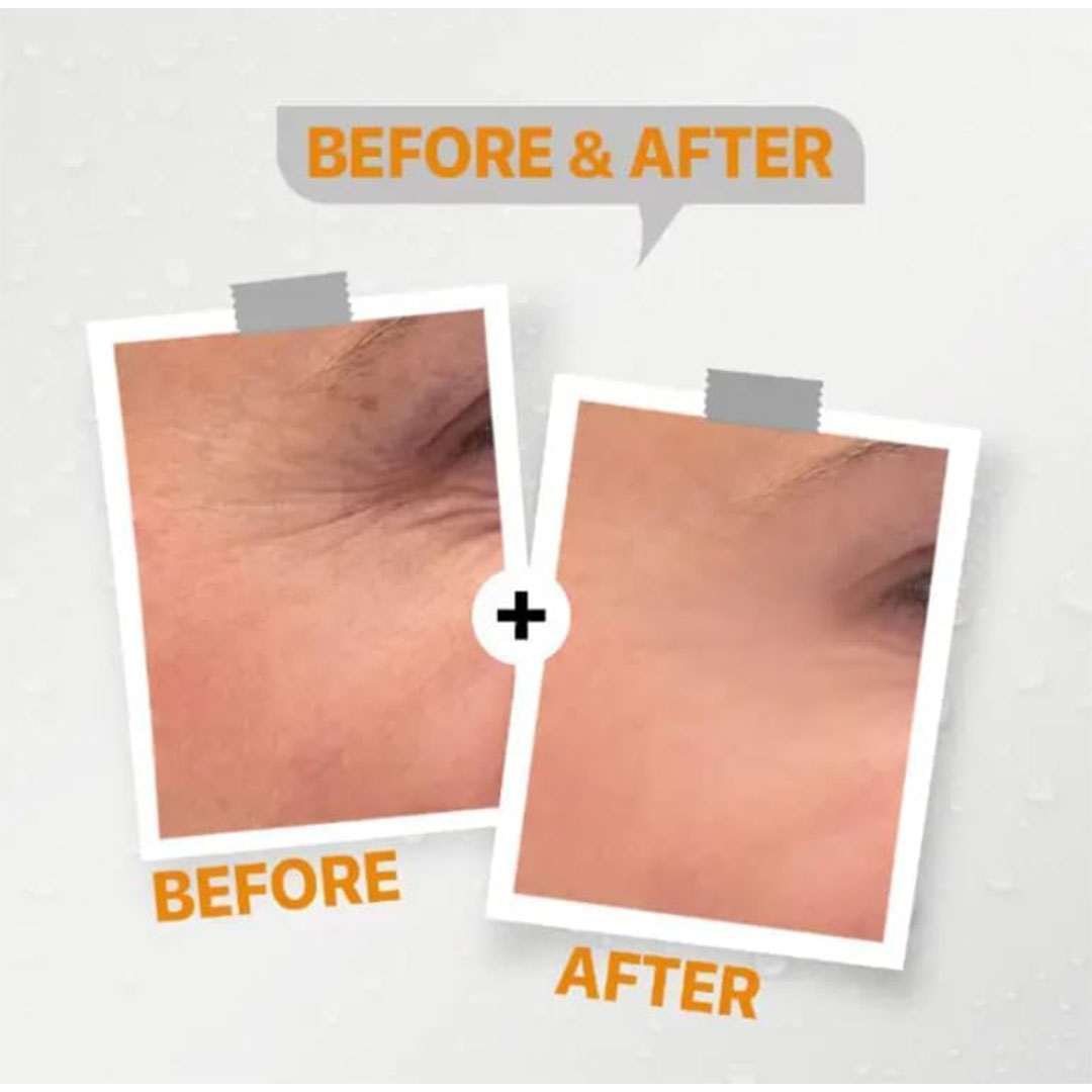 سيروم فيتامين سي من سي ليت - قطعتين