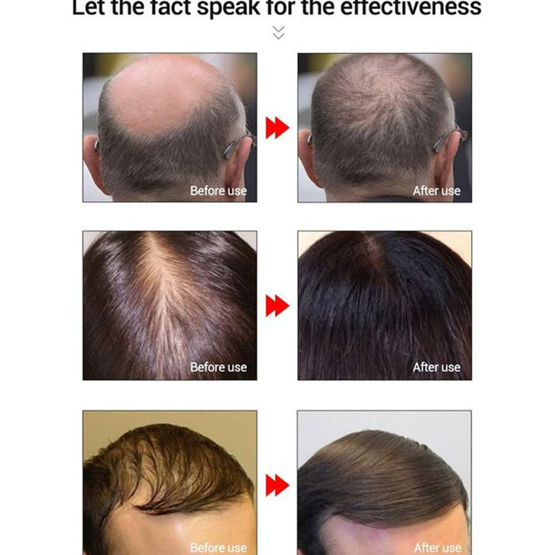 زيت لانبينا العطري المغذي للشعر - 20 مل