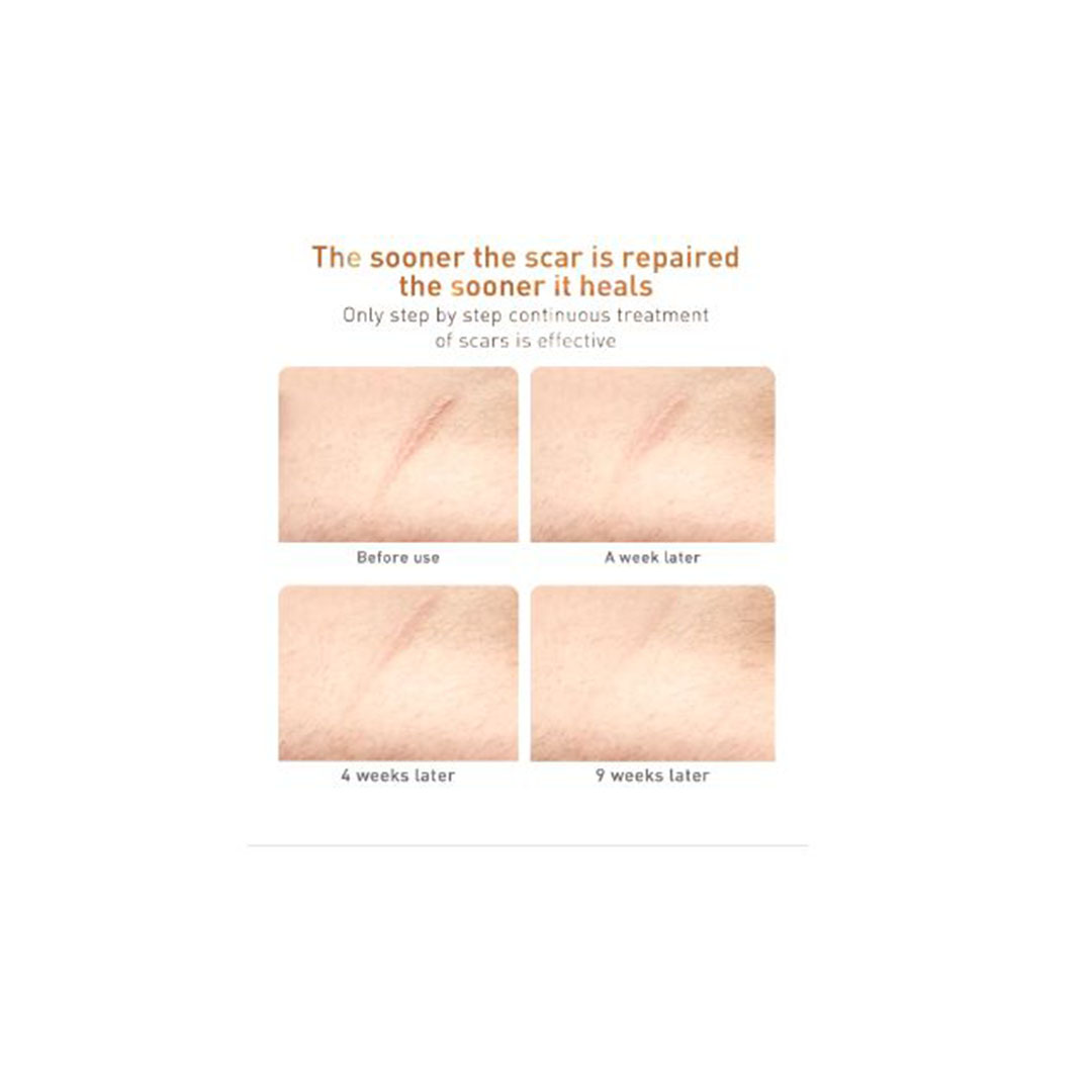 جل لانبينا للعناية بالبشرة لتحسين علامات التقدم في السن - 30 جرام