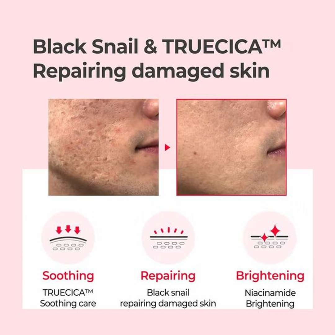 تونر البشرة بمستخلص الحلزون من سوم باي مي - 150 مل