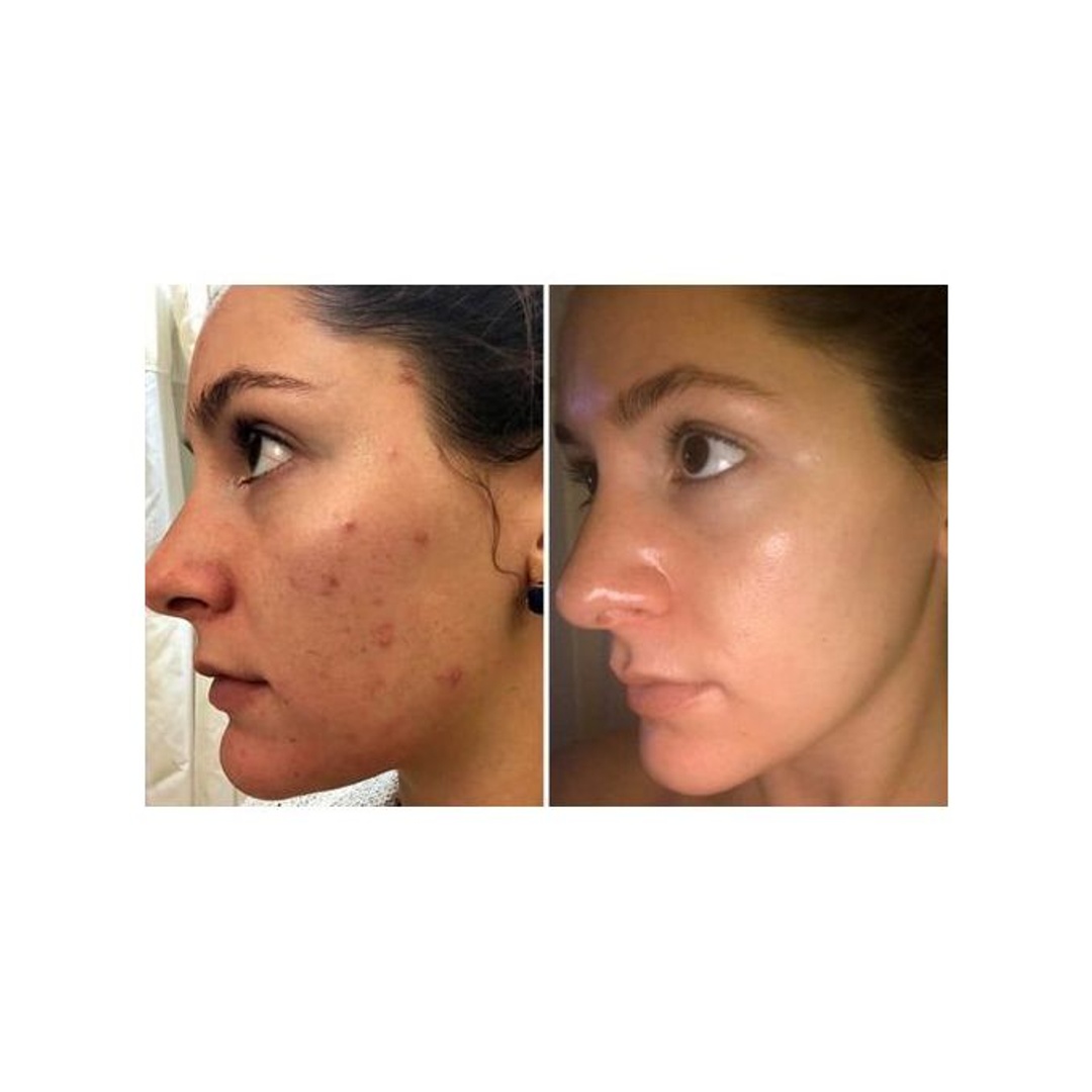 مقشر مشمش خالي من الزيوت من سانت آيفز - 170 جم