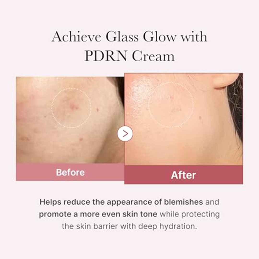 كريم للوجه من ميديكيوب لترطيب البشرة بعمق - للبشرة الجافة - 50 مل