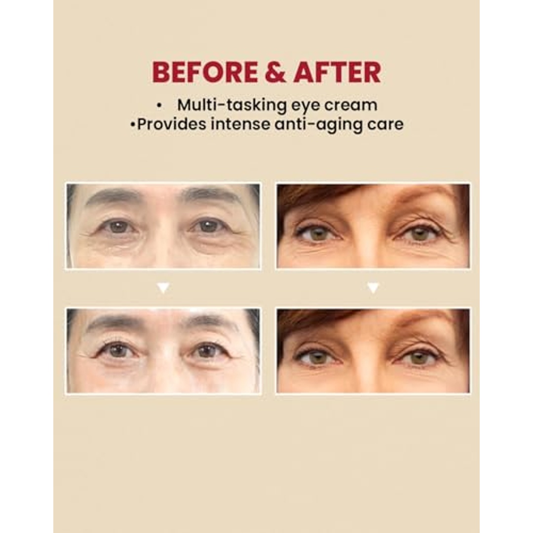 كريم العيون ليبوسوم الشبكية 4% + حبوب مخمرة - 30 مل