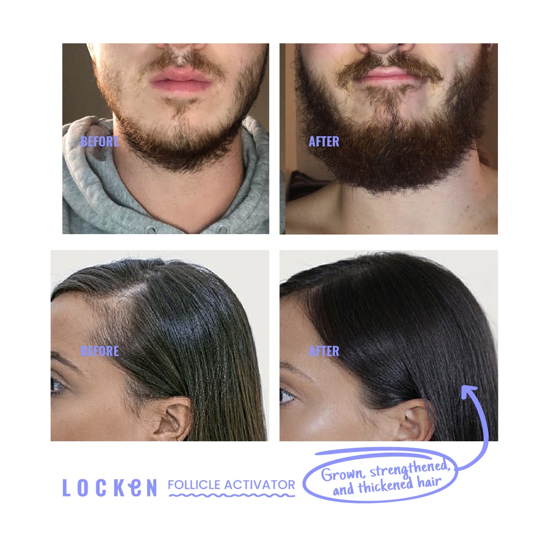 منشط بصيلات الشعر لوكن Rooting For You - 100 مل