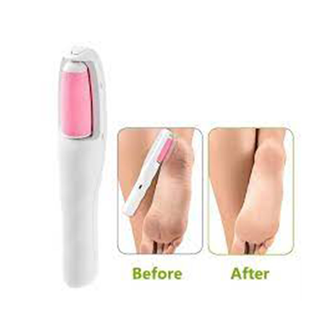 مبرد إلكتروني لإزالة الجلد الميت - شحن تايب سي