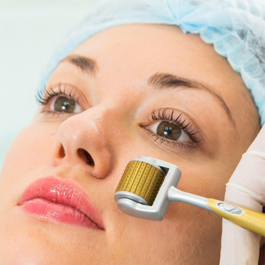 ديرما رولر ذهبي 0.5 + إبرة بثور هدية