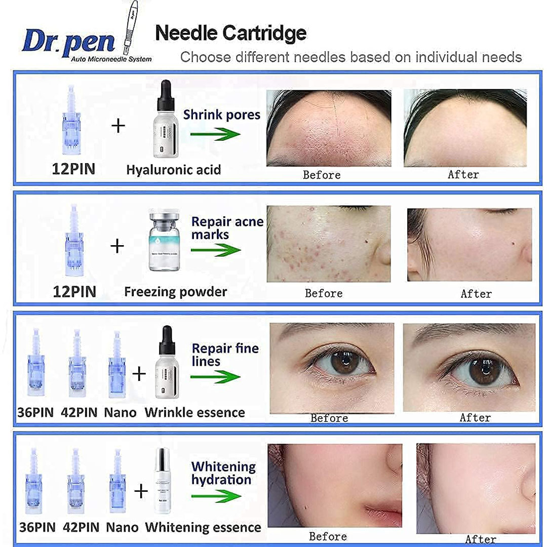 A6 قلم ديرما كهربائي - سنون 0.25 الي 2.5